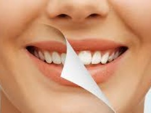 Dişleri Beyazlatmak İçin Portakal Esansiyel Yağı Nasıl Kullanılır?