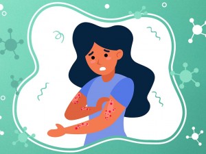 Sedef Hastalığı Nedir? Sedef Hastalığı Tedavisinde Aromaterapi Uçucu Yağlar Nasıl Kullanılır?
